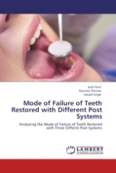 Mode of Failure of Teeth Restored with Different Post Systems : Analyzing the Mode of Failure of Teeth Restored with Three Differnt Post Systems （Aufl. 2011. 104 S.）