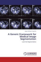 A Generic Framework for Medical Image Segmentation : Level Set Segmentation （Aufl. 2012. 56 S. 220 mm）