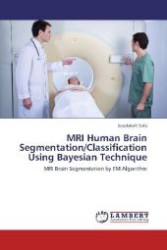 MRI Human Brain Segmentation/Classification Using Bayesian Technique : MRI Brain Segmentation by EM Algorithm （Aufl. 2012. 124 S. 220 mm）