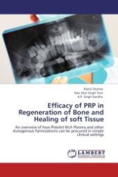 Efficacy of PRP in Regeneration of Bone and Healing of soft Tissue : An overview of how Platelet Rich Plasma and other Autogenous formulations can be procured in simple clinical settings （Aufl. 2012. 152 S. 220 mm）