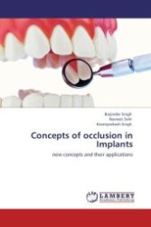 Concepts of occlusion in Implants : new concepts and their applications （Aufl. 2012. 140 S. 220 mm）