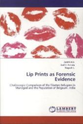 Lip Prints as Forensic Evidence : Cheiloscopic Comparison of the Tibetan Refugees in Mundgod and the Population of Belgaum, India （Aufl. 2012. 108 S. 219 x 150 mm）