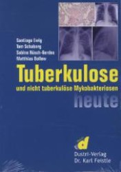 Tuberkulose und nicht tuberkulöse Mykobakteriosen heute （3., neubearb. u. erw. Aufl. 2011. 175 S. 23 cm）