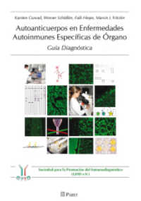 Autoanticuerpos en Enfermedades Autoinmunes Específicas de Órgano - Guía Diagnóstica （2014. 344 S. 21 cm）