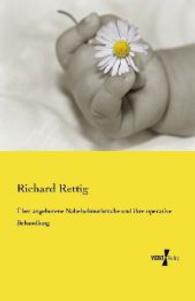 Ueber angeborene Nabelschnurbruche und ihre operative Behandlung -- Paperback / softback (German Language Edition)