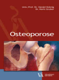 Osteoporose （2016. 168 S. 220 mm）