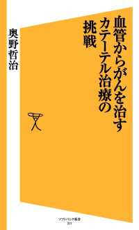 血管からがんを治す カテーテル治療の挑戦