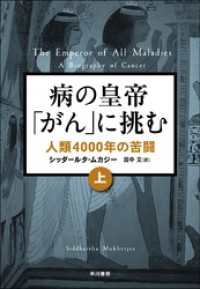 病の皇帝「がん」に挑む（上）人類４０００年の苦闘 単行本