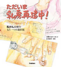 ただいま、乳房再建中！ もうひとつの選択肢