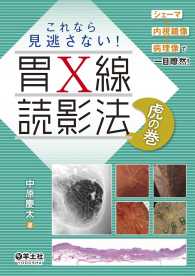 これなら見逃さない！　胃X線読影法　虎の巻