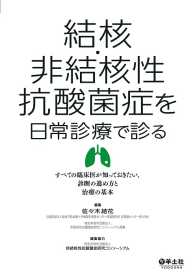 結核・非結核性抗酸菌症を日常診療で診る - すべての臨床医が知っておきたい、診断の進め方と治療