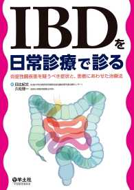 IBDを日常診療で診る - 炎症性腸疾患を疑うべき症状と、患者にあわせた治療法