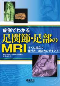 症例でわかる足関節・足部のMRI - すぐに役立つ撮り方・読み方のポイント