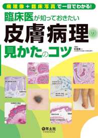 臨床医が知っておきたい皮膚病理の見かたのコツ