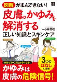 図解 がまんできない！ 皮膚のかゆみを解消する正しい知識とスキンケア