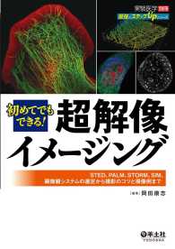 初めてでもできる！超解像イメージング - STED、PALM、STORM、SIM、顕微鏡シス