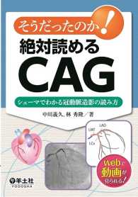 そうだったのか！　絶対読めるCAG - シェーマでわかる冠動脈造影の読み方