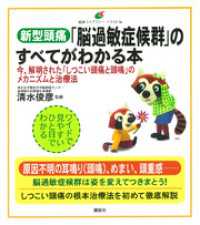 新型頭痛「脳過敏症候群」のすべてがわかる本　今、解明された「しつこい頭痛と頭鳴」のメカニズムと治療法