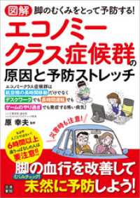 図解 エコノミークラス症候群の原因と予防ストレッチ