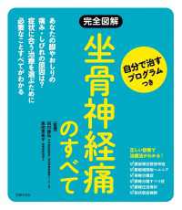 完全図解　坐骨神経痛のすべて　自分で治すプログラムつき 徹底対策シリーズ