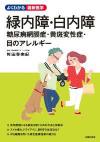 緑内障・白内障　糖尿病網膜症・黄斑変性症・目のアレルギー よくわかる最新医学シリーズ