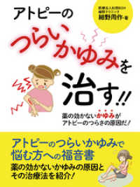 アトピーのつらいかゆみを治す！！　――薬の効かないかゆみがアトピーのつらさの原因だ！──