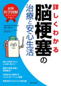 最新医学図解　詳しくわかる脳梗塞の治療と安心生活