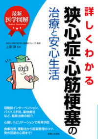 最新医学図解　詳しくわかる狭心症・心筋梗塞の治療と安心生活