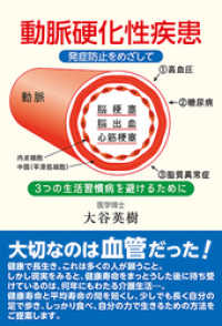 動脈硬化性疾患―発症防止をめざして