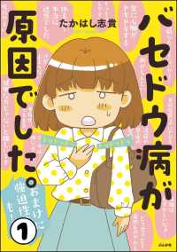 バセドウ病が原因でした。おまけに強迫性障害も！（分冊版） 【第1話】