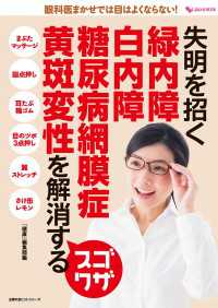 主婦の友ヒットシリーズ<br> 失明を招く　緑内障　白内障　糖尿病網膜症　黄斑変性を解消するスゴワザ