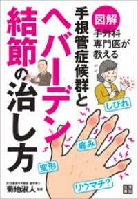 図解 手外科専門医が教える 手根管症候群とヘバーデン結節の治し方