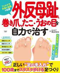 外反母趾、巻き爪、たこ・うおの目を自力で治す 扶桑社ムック