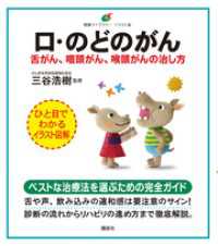 口・のどのがん　舌がん、咽頭がん、喉頭がんの治し方