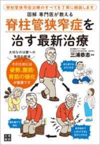 図解　専門医が教える　脊柱管狭窄症を治す最新治療