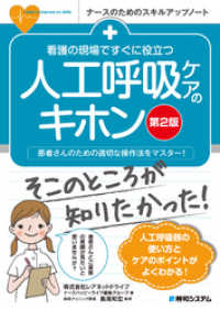 看護の現場ですぐに役立つ 人工呼吸ケアのキホン [第2版]