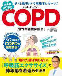 扶桑社ムック<br> 呼吸器専門医が教えるCOPD