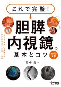 これで完璧！胆膵内視鏡の基本とコツ - “うまくいかない”を解決する目からウロコのエキスパ