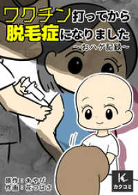 ワクチン打ってから脱毛症になりました～おハゲ記録～ 4巻〈坊主にしようかな〉 カクコミ