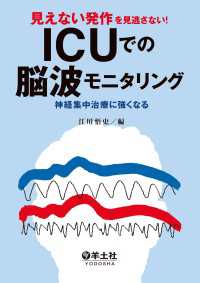 見えない発作を見逃さない！ICUでの脳波モニタリング - 神経集中治療に強くなる