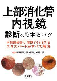 上部消化管内視鏡診断の基本とコツ - 内視鏡検査の「実際どうする？」をエキスパートがすべ