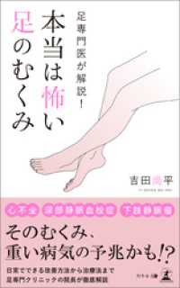 足専門医が解説！ 本当は怖い足のむくみ