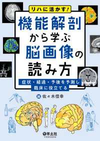 リハに活かす！機能解剖から学ぶ脳画像の読み方 - 症状・経過・予後を予測し臨床に役立てる