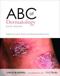 皮膚科学のABC（第５版）<br>ABC of Dermatology（5）