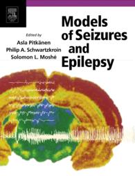 発作とてんかんのモデル<br>Models of Seizures and Epilepsy