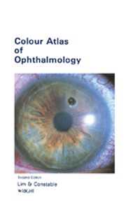 Colour Atlas of Ophthalmology（2）