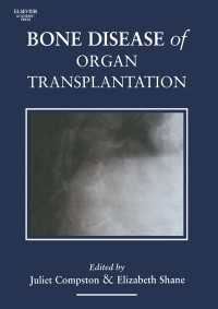 臓器移植における骨の疾患<br>Bone Disease of Organ Transplantation