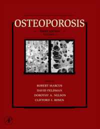 骨粗鬆症（第３版・全２巻）<br>Osteoporosis（3）