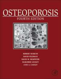 骨粗鬆症（第４版・全２巻）<br>Osteoporosis（4）