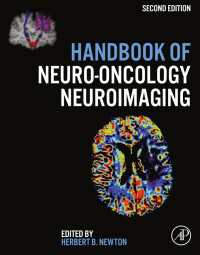 Handbook of Neuro-Oncology Neuroimaging（2）